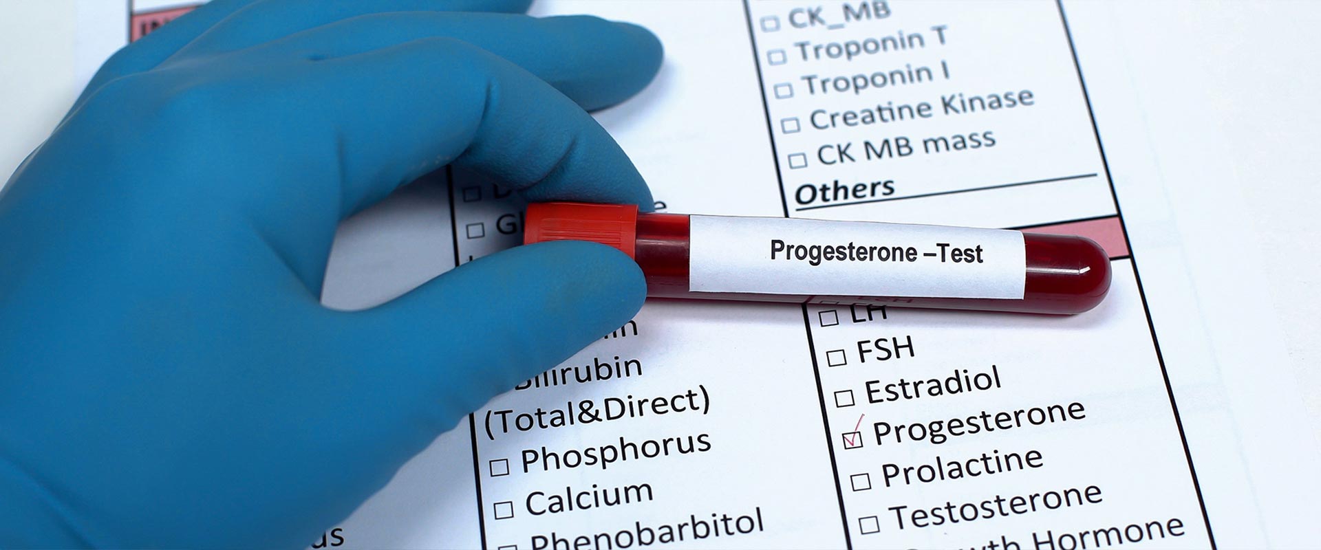 Blutprobe mit der Aufschrift „Progesteron-Test“ wird von einer behandschuhten Hand gehalten.